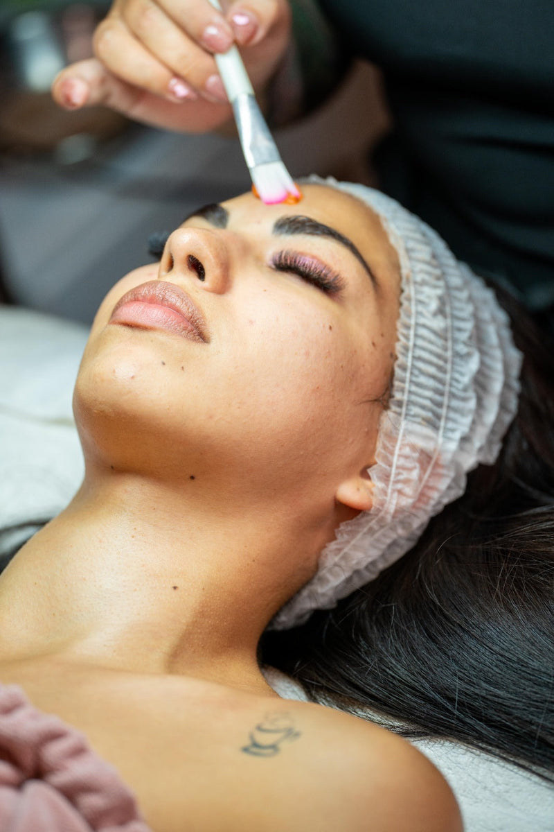 Tratamientos Faciales